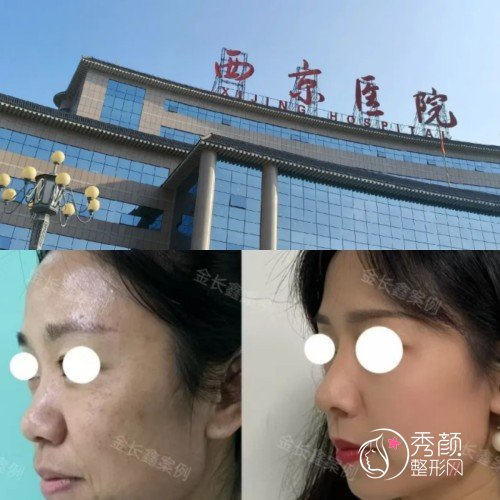 2026西京医院整容价目表-西京医院整形科收费标准一览