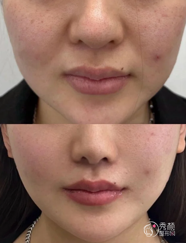 青岛童颜针认证医生排名：李铁铮、姜哲、阮潇舒等医生实力上榜