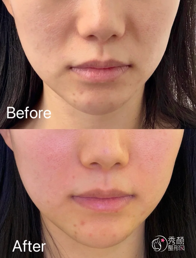 武汉童颜针认证医生排名：陶娅、朱胜军、邱新宇、张鹏飞等医生实力上榜