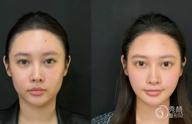 北京童颜针认证医生排名：周敏茹、高明英、杜晓红等医生实力上榜