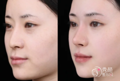 北京爱贝芙认证医生排名：周福田、田博文、陈力杨、谷亦涵等医生实