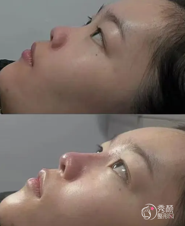 南京爱贝芙认证医生排名：秦琴、朱儒胜、辛海龙等医生实力上榜