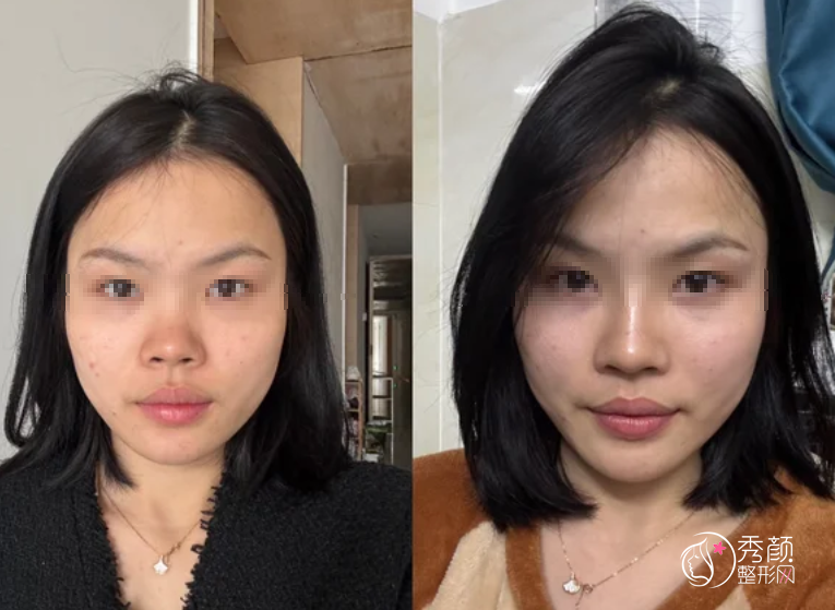 广州爱贝芙认证医生排名：曾东、陈柯、陈超越、李丰霞等医生实力上榜