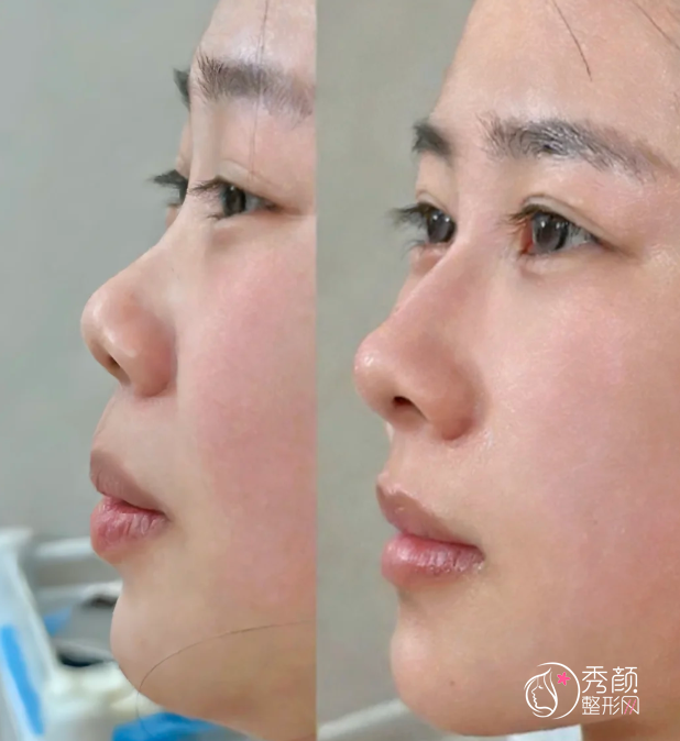 深圳爱贝芙认证医生排名：祁峰、富娜、黄凯等医生实力上榜