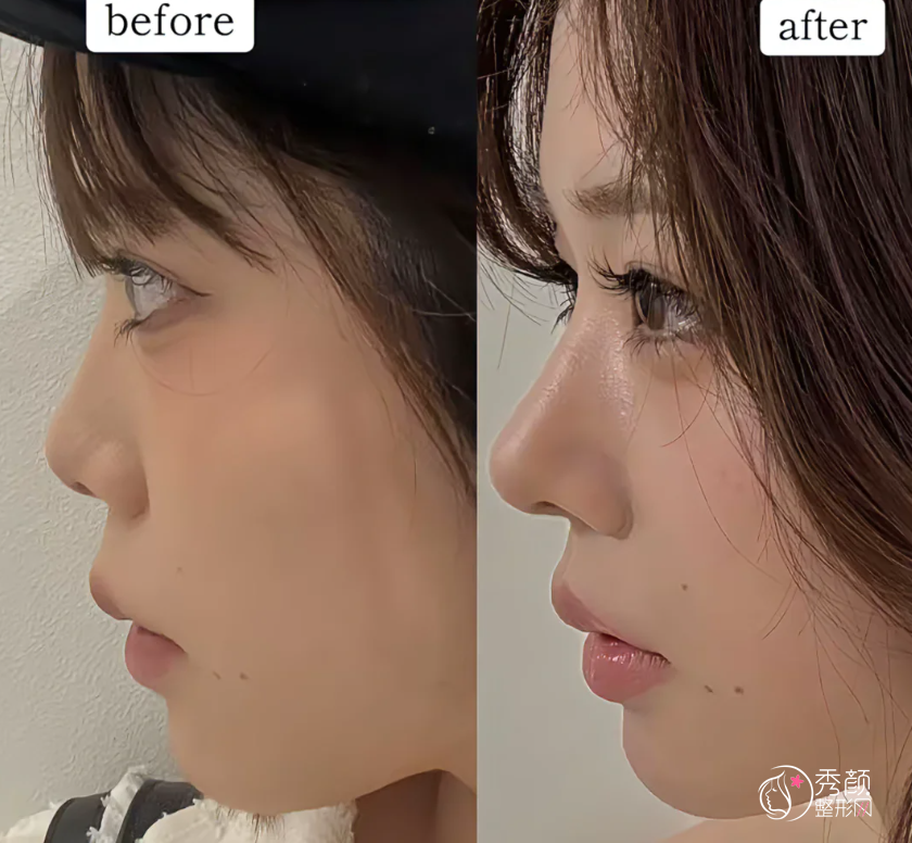 武汉爱贝芙认证医生排名：朱胜军、陈亚明、张鹏飞等医生实力上榜