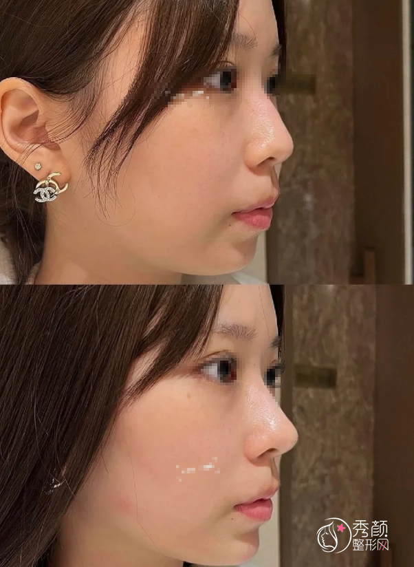 长沙爱贝芙认证医生排名：郭凌宇、潘卫峰、邓涵等医生实力上榜