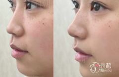 济南宝尼达认证医生排名：李玉茹、刘近兰、于杰等医生实力上榜