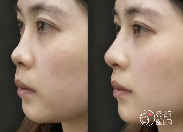 长沙宝尼达认证医生排名：聂桥林、田娟、邓涵等医生实力上榜