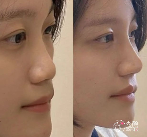 杭州宝尼达认证医生排名：郭江花、崔晶莹、谭琳琳等医生实力上榜