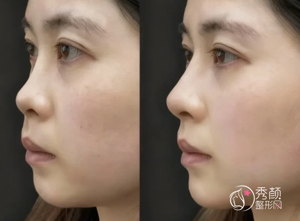 成都宝尼达认证医生排名：谢雯、王晓斌、雷国婕等医生实力上榜