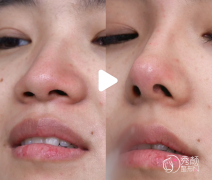 上海宝尼达认证医生排名：申涛、胡丽萍、郭敬松等医生实力上榜