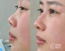 成都乔雅登认证医生白名单曝光：公立/私立根据自己的情况选择！