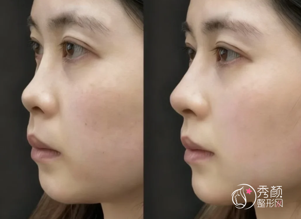 济南爱贝芙认证医生排名：刘近兰、王召东、马焕然等医生上榜