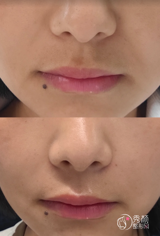 上海乔雅登认证医生排名：黄晔文、顾建英、孙璧乔等医生实力上榜