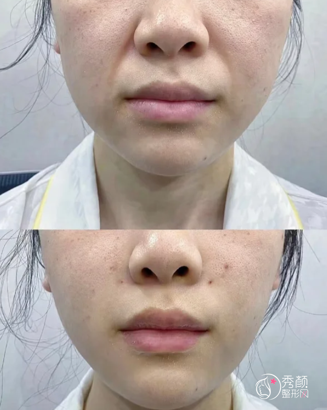 南京乔雅登认证医生排名：侯祚琼、易朝华、吴文欢等医生实力上榜