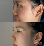 广州乔雅登认证医