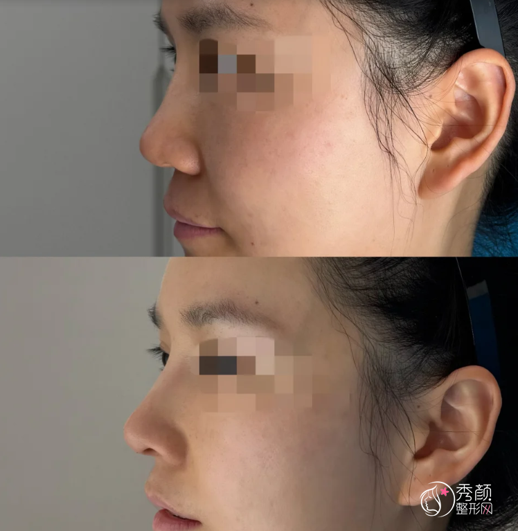 广州乔雅登认证医生排名：蔡俊荣、张小芸、郭跃等医生实力上榜