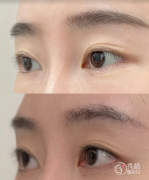 深圳乔雅登认证医