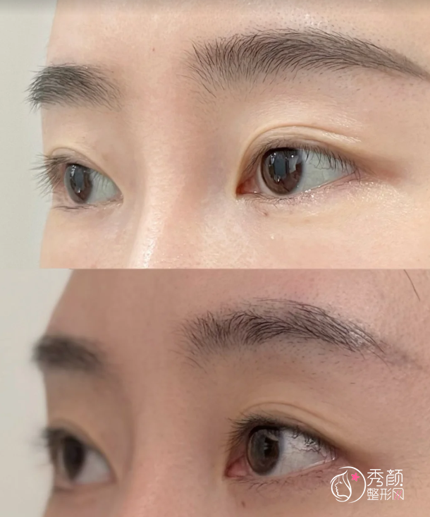 深圳乔雅登认证医生排名：王展、刘冰玉、黄海龙等医生实力上榜