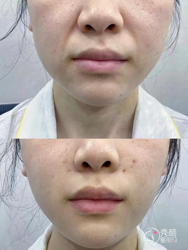 长沙乔雅登认证医生排名：王永洁、袁妍妍、赵莉等医生实力上榜