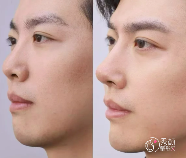 南京鼻综合医生排名：冯思阳、林金德、李理等医生实力上榜