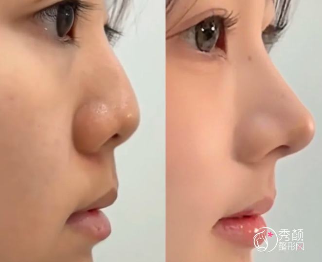 济南鼻综合医生排名：薛提朋、陈朋、王召东等医生实力上榜