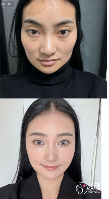 济南自体脂肪丰面颊医生排名：胡振生、霍然、安纲等医生实力上榜