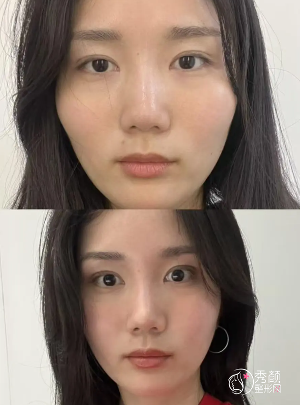 济南颧骨内推医生排名：王法刚、李东、霍然等医生实力上榜