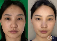 重庆埋线提升医生排名：王皓、徐赤宇、杨任欢等医生实力上榜