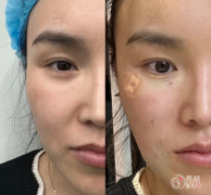 长沙埋线提升医生排名：雷少榕、王少华、朱轶等医生实力上榜