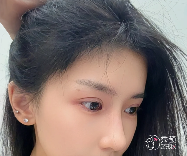 南京鼓楼医院植发多少钱一个毛囊，哪个医生好？植发医生介绍