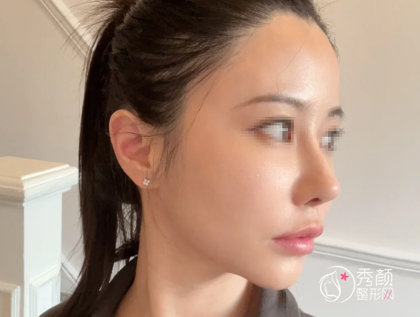 山东齐鲁医院隆鼻多少钱？哪个医生好？隆鼻医生介绍