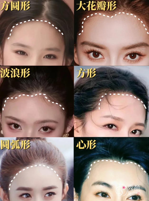 深圳植发公立医院哪家好？南方医科大学深圳医院、深圳市人民医院等