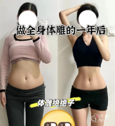 广东省人民医院吸脂多少钱，哪个医生好？邝石峰等吸脂医生介绍