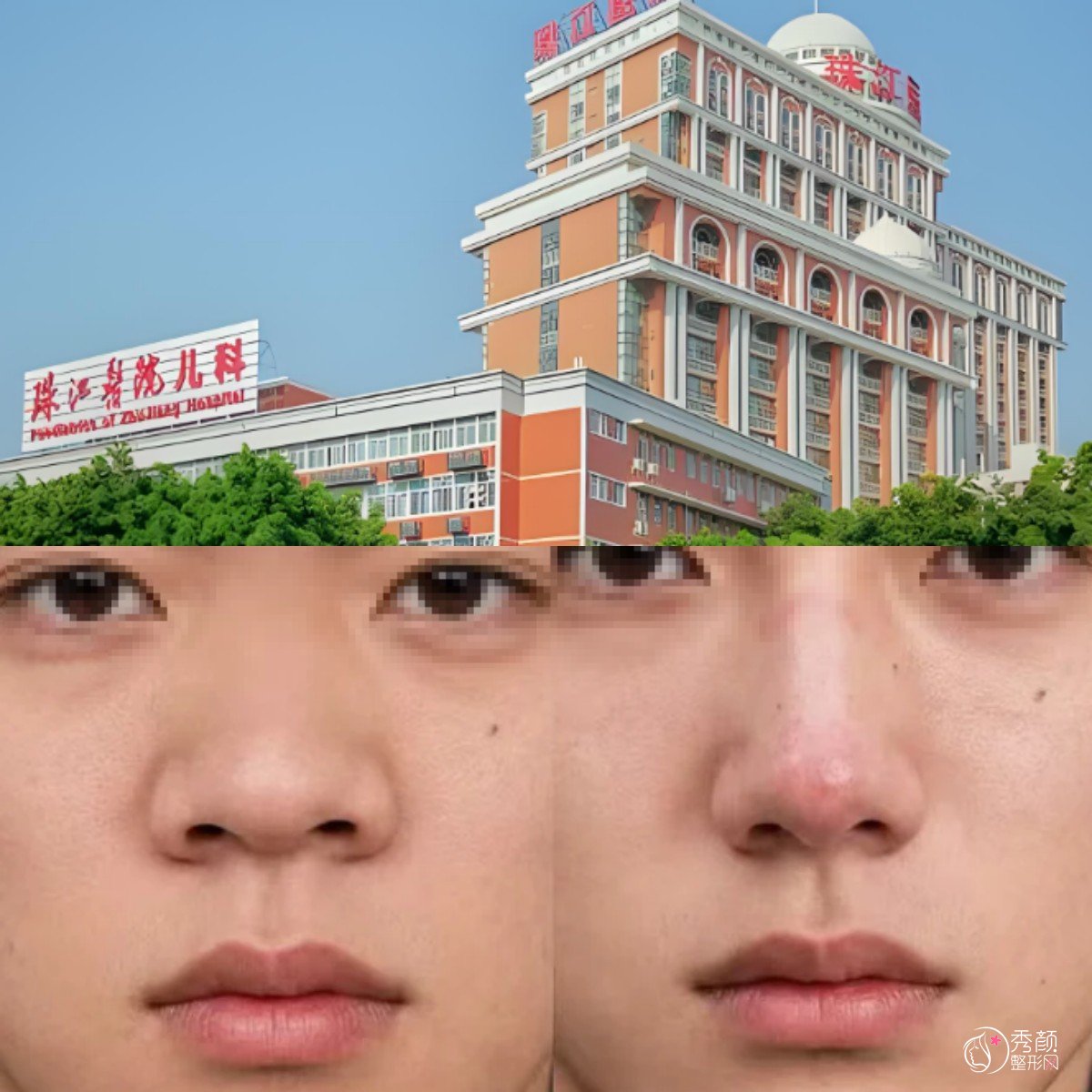 2026广州珠江医院整形科价目表（收费标准）一览