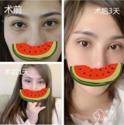 马娟眼修复怎么样？资质硬核、专业技术强、个性化设计…