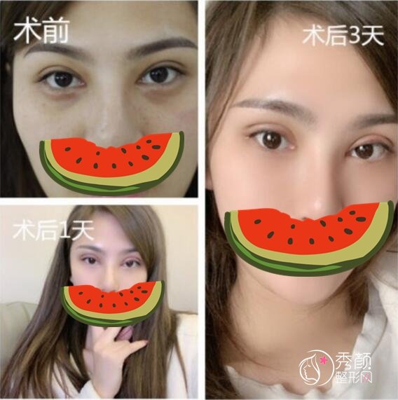 马娟眼修复怎么样？资质硬核、专业技术强、个性化设计…