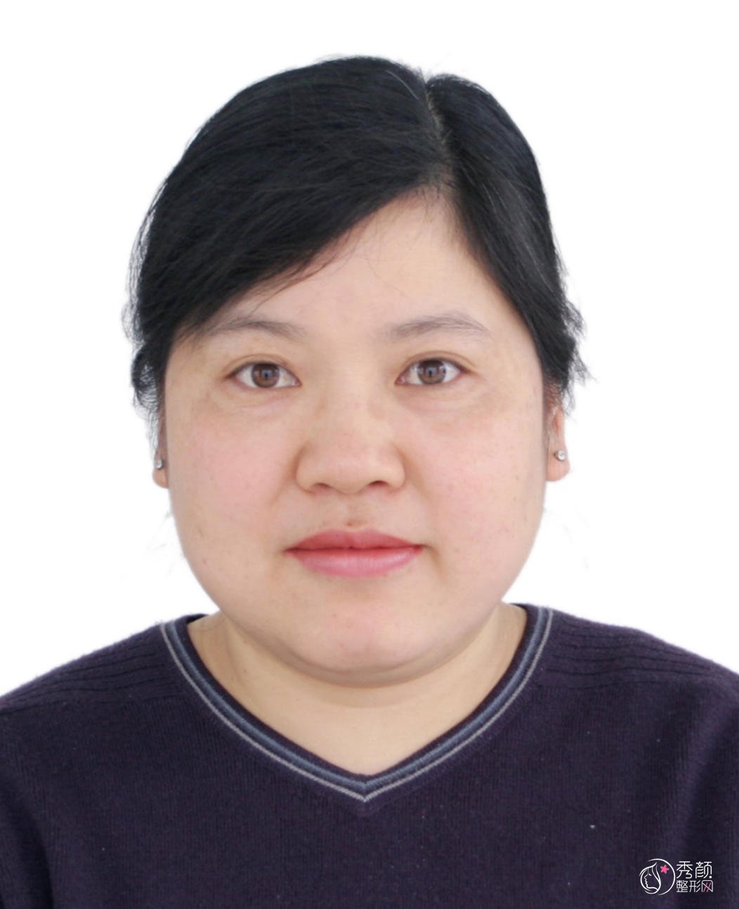 石杭燕双眼皮怎么样？塑形特点强、营造自然美感，内含坐诊机构&案例