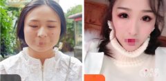 成都下颌骨手术哪家强？