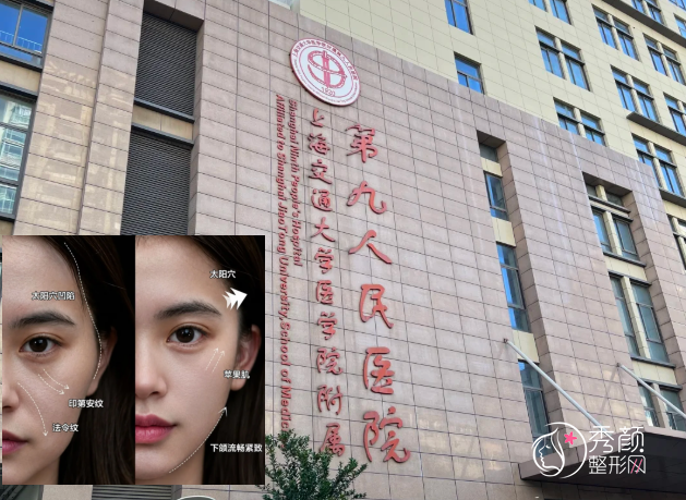 上海九院玻尿酸填充怎么样，多少钱一支，哪个医生好？详细介绍