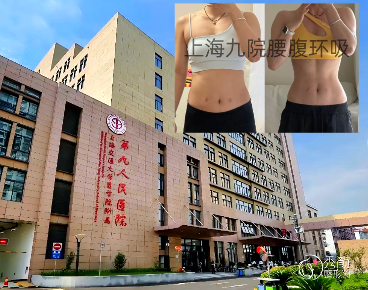 上海九院腰腹吸脂怎么样，多少钱，哪个医生好？