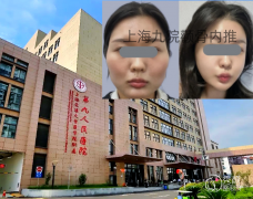 上海九院颧骨内推手术做得怎么样，多少钱？柴岗等磨骨医生介绍