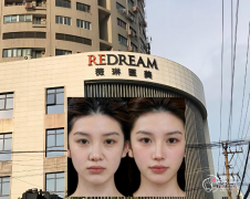 上海薇琳乔雅登注射怎么样，多少钱一支，哪个医生好？