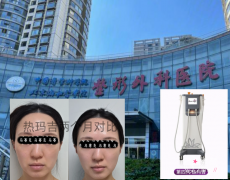 北京八大处热玛吉多少钱一次？第四代热玛吉12000元起