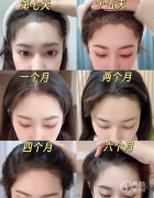 北京植发医院排名：北京