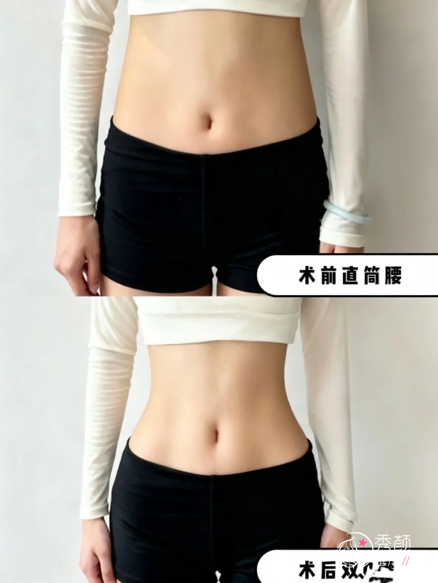 东莞吸脂哪家医院好？人民医院、西妃、美立方等这五家口碑医院医生整理