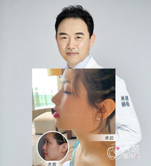 北京隆鼻哪个医生好？李劲良、巫文云、刘彦军实力太夯！